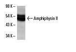 Amphiphysin II (2F11): sc-23918. Western blot analysis of Amphiphysin II expression in L8 whole cell lysate.