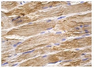Amphiphysin II (2F11): sc-23918. Immunoperoxidase staining of formalin fixed, paraffin-embedded human skeletal muscle tissue showing cytoplasmic staining of myocytes.