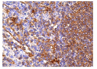 Amphiphysin II (D-3): sc-74486. Immunoperoxidase staining of formalin fixed, paraffin-embedded human spleen tissue showing cytoplasmic staining of cells in red and white pulps.