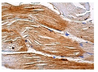 Amphiphysin II (G-10): sc-74487. Immunoperoxidase staining of formalin fixed, paraffin-embedded human skeletal muscle tissue showing cytoplasmic staining of myocytes.