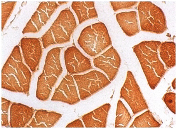 Amphiphysin II (H-100): sc-30099. Immunoperoxidase staining of formalin fixed, paraffin-embedded human skeletal muscle tissue showing cytoplasmic and nuclear staining of myocytes.
