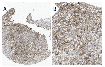 apoA-I (A5.4): sc-13549. Immunoperoxidase staining of formalin fixed, paraffin-embedded human adrenal gland tissue showing membrane and cytoplasmic staining of cortical cells at low (A) and high (B) magnification. Kindly provided by The Swedish Human Protein Atlas (HPA) program.