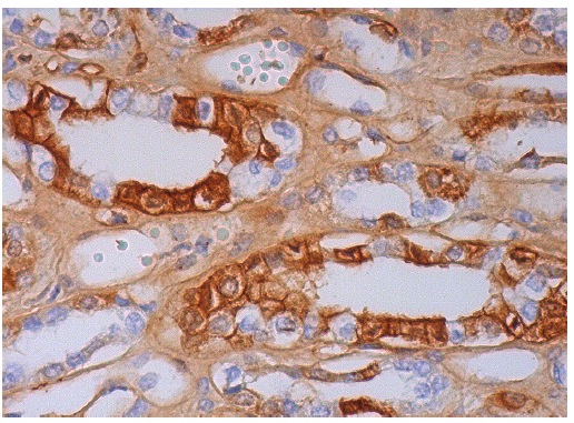 apoA-I (A5.4): sc-13549. Immunoperoxidase staining of formalin fixed, paraffin-embedded human kidney tissue showing cytoplasmic and membrane staining of cells in tubules.