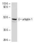 arfaptin 1 (I-19): sc-19246. Western blot analysis of arfaptin 1 expression in JAR whole cell lysate.