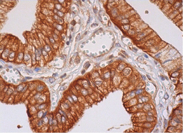 arfaptin 1 (I-19): sc-19246. Immunoperoxidase staining of formalin fixed, paraffin-embedded human gall bladder tissue showing cytoplasmic and membrane staining of glandular cells.