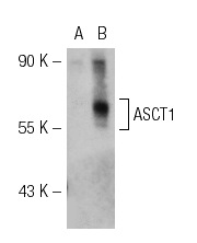 ASCT1 (P-12): sc-50807. Western blot analysis of ASCT1 expression in non-transfected: sc-117752 (A) and human ASCT1 transfected: sc-111588 (B) 293T whole cell lysates.
