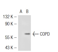 COPD (W-20): sc-28515. Western blot analysis of COPD expression in non-transfected: sc-117752 (A) and mouse COPD transfected: sc-119394 (B) 293T whole cell lysates.