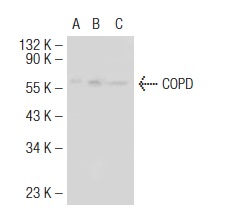 COPD (W-20): sc-28515. Western blot analysis of COPD expression in non-transfected 293T: sc-117752 (A), mouse COPD transfected 293T: sc-119396 (B) and NIH/3T3 (C) whole cell lysates.