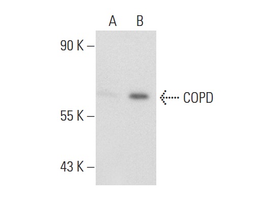 COPD (W-20): sc-28515. Western blot analysis of COPD expression in non-transfected: sc-117752 (A) and mouse COPD transfected: sc-119397 (B) 293T whole cell lysates.