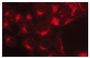 γ2-COP (C-20): sc-14165. Immunofluorescence staining of methanol-fixed HeLa cells showing cytoplasmic localization.