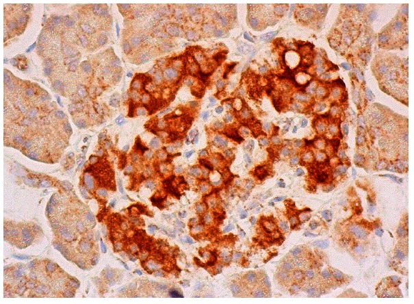γ2-COP (S-21): sc-23204. Immunoperoxidase staining of formalin fixed, paraffin-embedded human pancreas tissue showing cytoplasmic staining of exocrine glandular cells and Islets of Langerhans.