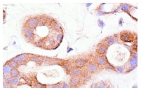 CRABP-II (K-13): sc-10065. Immunoperoxidase staining of formalin-fixed, paraffin-embedded human breast tissue showing cytoplasmic staining.