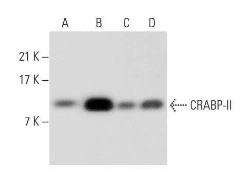 CRABP-II (K-13): sc-10065. Western blot analysis of CRABP-II expression in A-431 (A), HT-29 (B), MCF7 (C) and HCT-116 (D) whole cell lysates.