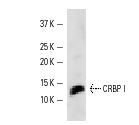 CRBP I (FL-135): sc-30106. Western blot analysis of CRBP I expression in SCC-4 whole cell lysate.
