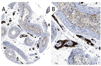 CRBP I (FL-135): sc-30106. Immunoperoxidase staining of formalin fixed, paraffin-embedded human testis tissue showing cytoplasmic staining of Leydig cells and cells in seminiferus ducts at low (A) and high (B) magnification. Kindly provided by The Swedish Human Protein Atlas (HPA) program.