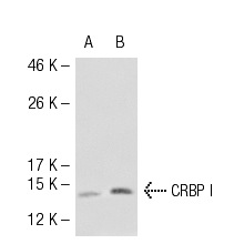 CRBP I (FL-135): sc-30106. Western blot analysis of CRBP I expression in non-transfected: sc-117752 (A) and mouse CRBP I transfected: sc-119443 (B) 293T whole cell lysates.