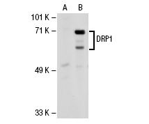 DRP1 (H-300): sc-32898. Western blot analysis of DRP1 expression in non-transfected: sc-117752 (A) and human DRP1 transfected: sc-113653 (B) 293T whole cell lysates.