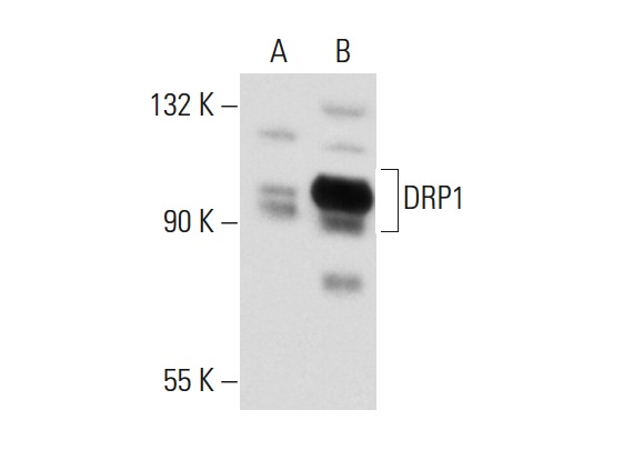 DRP1 (H-300): sc-32898. Western blot analysis of DRP1 expression in non-transfected: sc-117752 (A) and human DRP1 transfected: sc-171970 (B) 293T whole cell lysates.