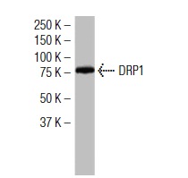 DRP1 (6Z-82): sc-101270. Western blot analysis of DRP1 expression in K-562 whole cell lysate.