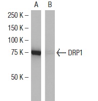 DRP1 (6Z-82): sc-101270 Western blot analysis of DRP1 expression in human DRP1 transfected (A) and non-transfected (B) 293T whole cell lysates.