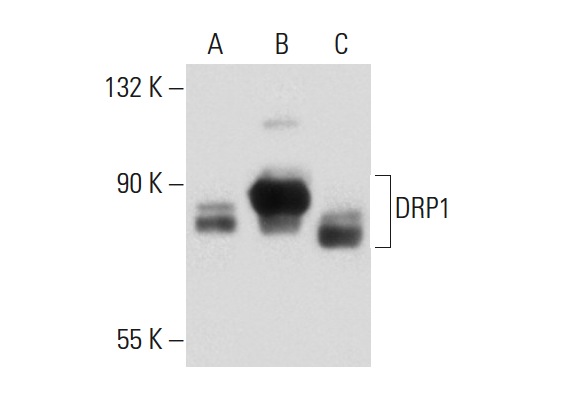 DRP1 (6Z-82): sc-101270. Western blot analysis of DRP1 expression in non-transfected 293T: sc-117752 (A), human DRP1 transfected 293T: sc-171970 (B) and K-562 (C) whole cell lysates.