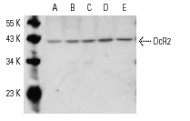DcR2 (D-15): sc-11638. Western blot analysis of DcR2 expression in M1 (A), c4 (B), RAW 264.7 (C), CTLL-2 (D) and WR 19L (E) whole cell lysates.