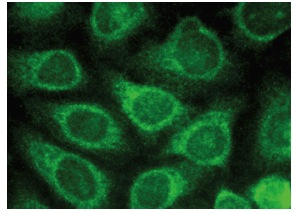 Endophilin B1 (G-6): sc-374146. Immunofluorescence staining of methanol-fixed HeLa cells showing cytoplasmic localization.