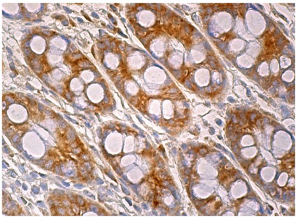 Endophilin B1 (G-6): sc-374146. Immunoperoxidase staining of formalin fixed, paraffin-embedded human rectum tissue showing cytoplasmic staining of glandular cells.