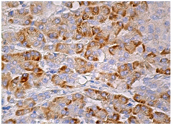 Hrs (D-11): sc-271160. Immunoperoxidase staining of formalin fixed, paraffin-embedded human pancreas tissue showing cytoplasmic staining of glandular cells.