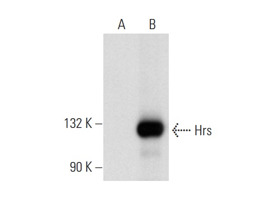 Hrs (D-11): sc-271160. Western blot analysis of Hrs expression in non-transfected: sc-117752 (A) and human Hrs transfected: sc-170644 (B) 293T whole cell lysates.