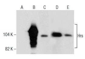 Hrs (D-11): sc-271160. Western blot analysis of Hrs expression in non-transfected 293: sc-110760 (A), human Hrs transfected 293: sc-159949 (B), HEL 92.1.7 (C), AML-193 (D) and K-562 (E) whole cell lysates.