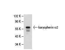 karyopherin α2 (1A6): sc-101538. Western blot analysis of karyopherin α2 expression in NIH/3T3 whole cell lysate.