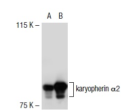 karyopherin α2 (1A6): sc-101538. Western blot analysis of karyopherin α2 expression in non-transfected: sc-117752 (A) and mouse karyopherin α2 transfected: sc-125512 (B) 293T whole cell lysates.