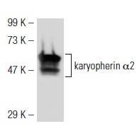 karyopherin α2 (2G7): sc-57009. Western blot analysis of karyopherin α2 expression in HeLa whole cell lysate.