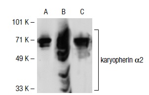 karyopherin α2 (2G7): sc-57009. Western blot analysis of karyopherin α2 expression in non-transfected 293T: sc-117752 (A), human karyopherin α2 transfected 293T: sc-116432 (B) and Jurkat (C) whole cell lysates.