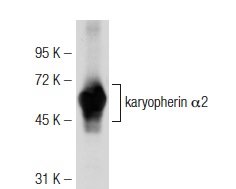 karyopherin α2 (2G7): sc-57009. Western blot analysis of karyopherin α2 expression in BJAB whole cell lysate.