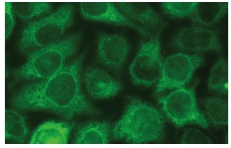 karyopherin α2 (G-11): sc-55537. Immunofluorescence staining of methanol-fixed HeLa cells showing cytoplasmic localization.