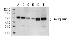karyopherin α2 (G-11): sc-55537. Western blot analysis of karyopherin α2 expression in HeLa nuclear extract (A) and A-375 (B), NIH/3T3 (C), RAW 264.7 (D), KNRK (E) and 3611-RF (F) whole cell lysates.