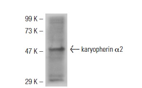 karyopherin α2 (G-11): sc-55537. Western blot analysis of karyopherin α2 expression in HeLa whole cell lysate.