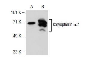 karyopherin α2 (G-11): sc-55537. Western blot analysis of karyopherin α2 expression in non-transfected: sc-117752 (A) and human karyopherin α2 transfected: sc-116432 (B) 293T whole cell lysates.