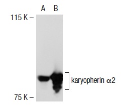 karyopherin α2 (G-11): sc-55537. Western blot analysis of karyopherin α2 expression in non-transfected: sc-117752 (A) and mouse karyopherin α2 transfected: sc-125512 (B) 293T whole cell lysates.