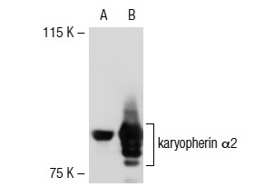 karyopherin α2 (G-11): sc-55537. Western blot analysis of karyopherin α2 expression in non-transfected: sc-117752 (A) and mouse karyopherin α2 transfected: sc-125513 (B) 293T whole cell lysates.