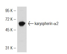 karyopherin α2 (G-11): sc-55537. Western blot analysis of karyopherin α2 expression in BJAB whole cell lysate.