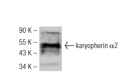 karyopherin α2 (H-50): sc-25522. Western blot analysis of karyopherin α2 expression in HeLa whole cell lysate.