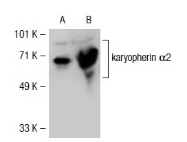 karyopherin α2 (H-50): sc-25522. Western blot analysis of karyopherin α2 expression in non-transfected: sc-117752 (A) and human karyopherin α2 transfected: sc-116432 (B) 293T whole cell lysates.