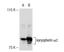 karyopherin α2 (H-50): sc-25522. Western blot analysis of karyopherin α2 expression in non-transfected: sc-117752 (A) and mouse karyopherin α2 transfected: sc-125512 (B) 293T whole cell lysates.