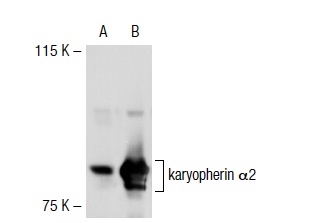 karyopherin α2 (H-50): sc-25522. Western blot analysis of karyopherin α2 expression in non-transfected: sc-117752 (A) and mouse karyopherin α2 transfected: sc-125513 (B) 293T whole cell lysates.