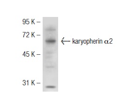 karyopherin α2 (H-50): sc-25522. Western blot analysis of karyopherin α2 expression in BJAB whole cell lysate.