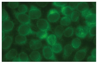 karyopherin β1 (H-7): sc-137016. Immunofluorescence staining of methanol-fixed HeLa cells showing cytoplasmic localization.