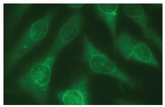 karyopherin β1 (H-7): sc-137016. Immunofluorescence staining of methanol-fixed NIH/3T3 cells showing cytoplasmic and nuclear envelope localization.